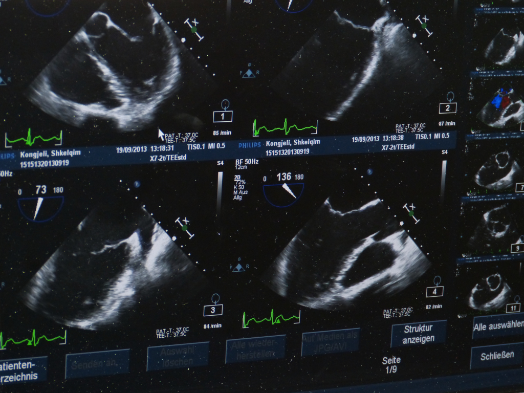 The Process of Ultrasound Imaging